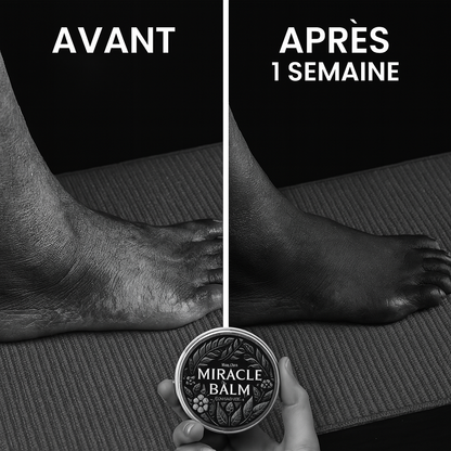 Baume miracle – Crème Apaisante pour les Articulations du Dos, des Jambes et des Pieds. Procure détente et confort.
