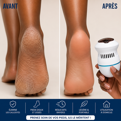 Ponceuse électrique pour les pieds