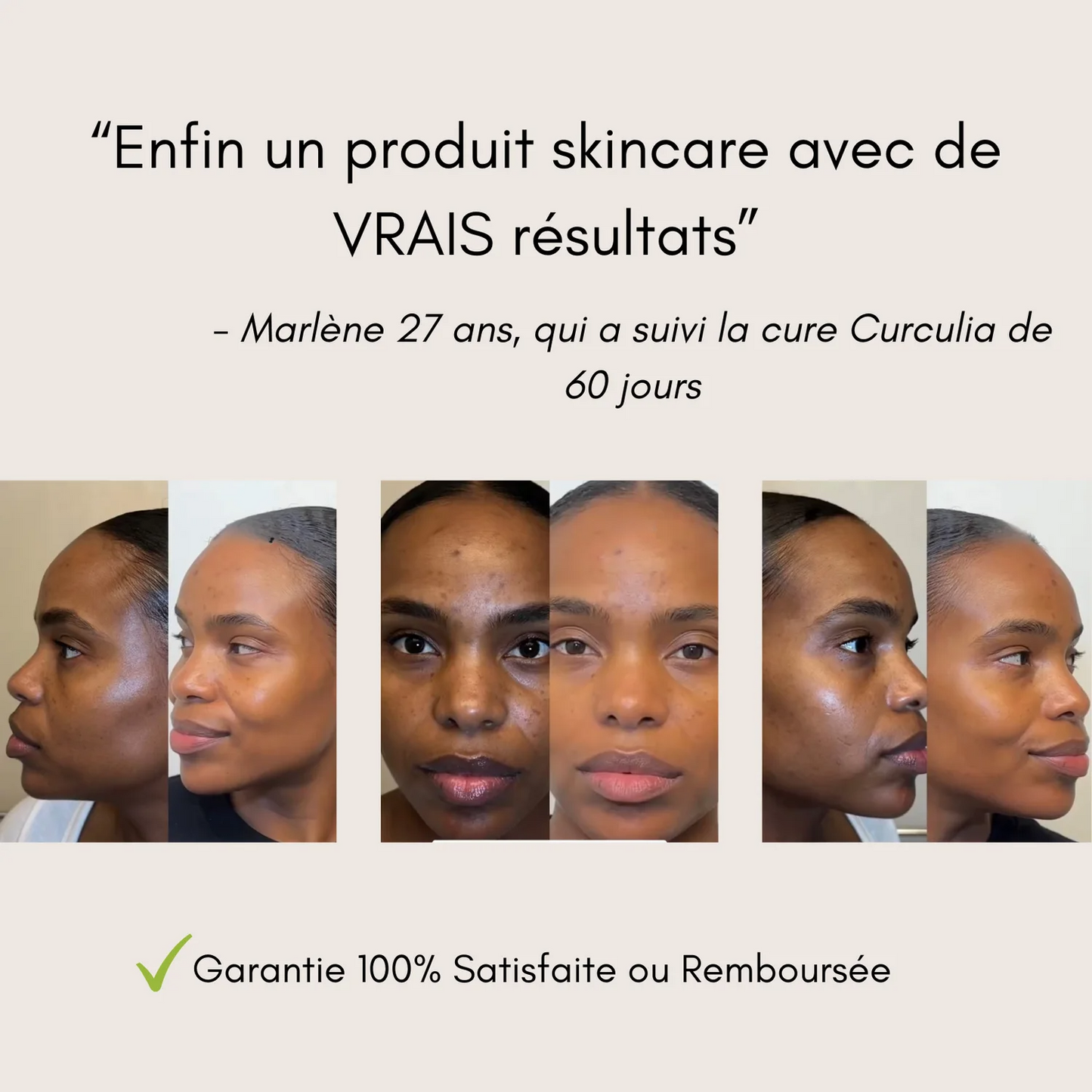 Lingettes Nettoyantes au Curcuma & Acide Kojique (50 pièces)