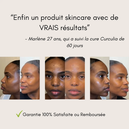 Lingettes Nettoyantes au Curcuma & Acide Kojique (50 pièces)