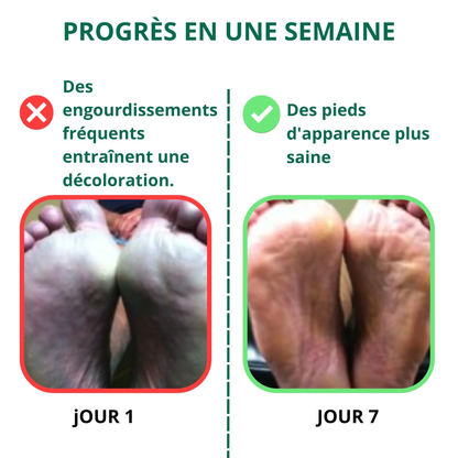 Baume miracle – Soulage varices, jambes lourdes, douleurs et brûlures aux pieds, douleurs articulaire, neuropathie dès la première application